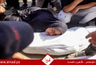 الصحة: ارتفاع ضحايا الحرب العدوانية على قطاع غزة  إلى 72,003 شهيد