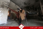 الصحة العالمية: أكثر من 5 آلاف فلسطيني خضعوا لبتر أطراف خلال حرب غزة