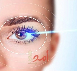 10 نصائح مهمة للوقاية من التهاب الملتحمة وتهيج العين فى الصيف