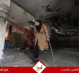 الصحة العالمية: أكثر من 5 آلاف فلسطيني خضعوا لبتر أطراف خلال حرب غزة