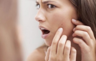 7 نصائح تساعدك في التخلص من حبوب الوجه سريعا