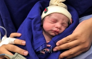 أمريكا تسجل أول ولادة بـ"رحم مزروع" من متبرعة متوفاة