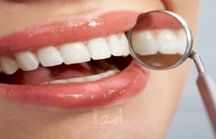 هل تُصدق حشو عصب الأسنان بدون ألم.. «طبيب» أسنان يُجيبك؟