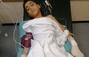 إصابة طفل في انفجار "جسم مشبوه" وسط قطاع غزة