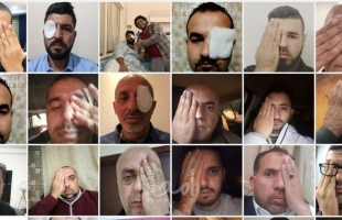 "عين معاذ" .. حملة إلكترونية تضامنًا مع المصور "معاذ عمارنة" الذي فقد عينه اليسرى برصاصة إسرائيلية