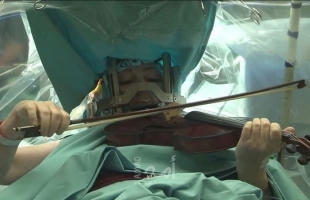 سيدة تعزف على الكمان أثناء خضوعها لجراحة دقيقة في المخ