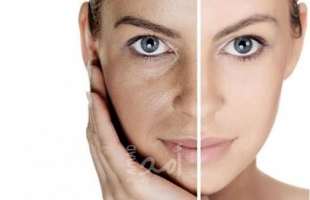 الطرق التجميلية لعلاج المسامات الواسعة في الوجه