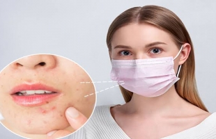 نصائح جديدة لحماية بشرتك من الكمامة