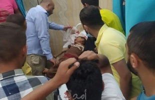 محدث.. الصحة: استشهاد (83) مواطناً بينهم 17 طفلا و6 سيدات وإصابة 487 في قطاع غزة