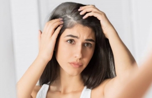3 أطعمة تقلل من ظهور الشعر الأبيض