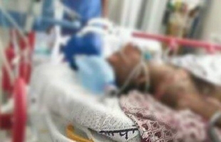 وفاة مواطن أقدم على حرق نفسه بمادة مشتغلة غرب غزة