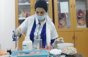 غزة: باحثة تسجل "تجارب سريرية" تكشف آفاق جديدة في علاج مرض التوحد