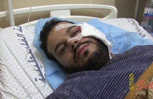 بعد إجراء فحوصات طبية في الأردن.. الصحفي "عطية درويش" يفقد عينه اليسرى كلياً