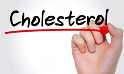 البصل يساعد في التحكم بمستويات الكوليسترول؟