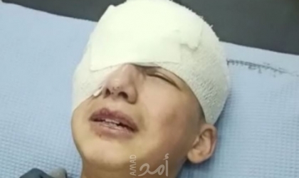الخليل: طفل يفقد عينه برصاص قوات الاحتلال