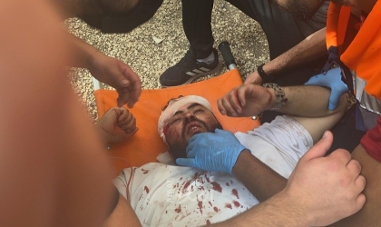 الهلال الأحمر: مئات الإصابات خلال اقتحام شرطة الاحتلال للمسجد الأقصى