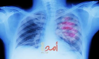 نصائح لمريض حساسية الصدر.. يجب اتباعها
