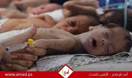 الضمير تصدر تقرير ميداني حول وفاة أكثر من ثلثي الأطفال الخدج بسبب حرب الابادة الجماعية في قطاع غزة