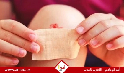 خبراء الصحة يحذرون من استخدام المناديل المبللة الخالية من الكحول على الجروح