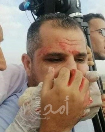 فصائل ومؤسسات تستنكر استهداف قوات الاحتلال لمصور الوكالة الوطنية "عاصم شحادة"
