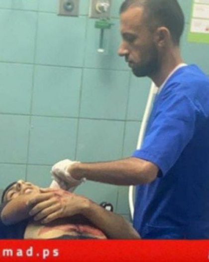 إصابة طفلين برصاص مستوطنين في دير قديس غرب رام الله